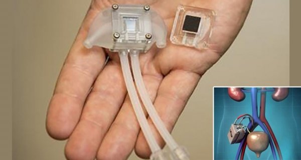 World’s First Artificial Kidney Is All Set To Replace Dialysis in 2-3 Years Image